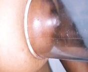 Penis pump treatment part 02 from south indian breast milk sex