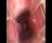 Preciosa anglosajona speculum cervix insertioon object from australianbeautiful girls vaginal exam