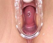 Cervix orgasm from cervix