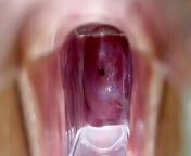 Stella St. Rose - Extreme Cervix Views and Juices Flowing Using a Speculum from sperm and ovem mix vidiosindu muslim